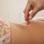 acupuncture pour soulager les règles douloureuses