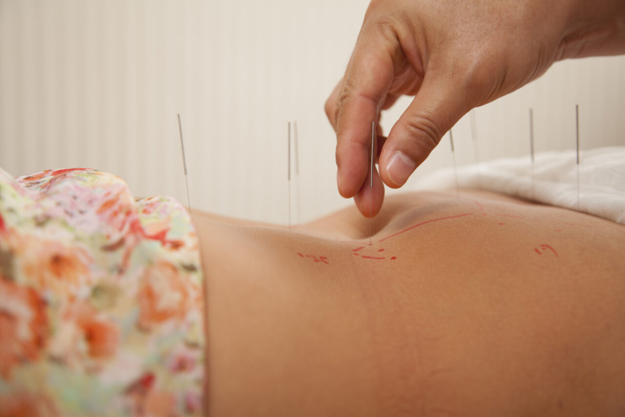 acupuncture pour soulager les règles douloureuses